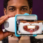 Suivi digital orthodontie : patient réalisant un scan Dental Monitoring avec son smartphone, orthodontiste La Possession