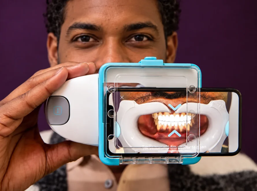 Suivi digital orthodontie : patient réalisant un scan Dental Monitoring avec son smartphone, orthodontiste La Possession